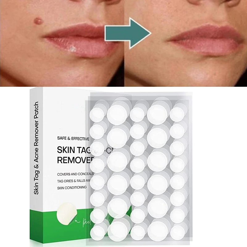 36pcs/sheet Acne Wart Remover Pimple Wart Treatment Patch Hydrocolloid