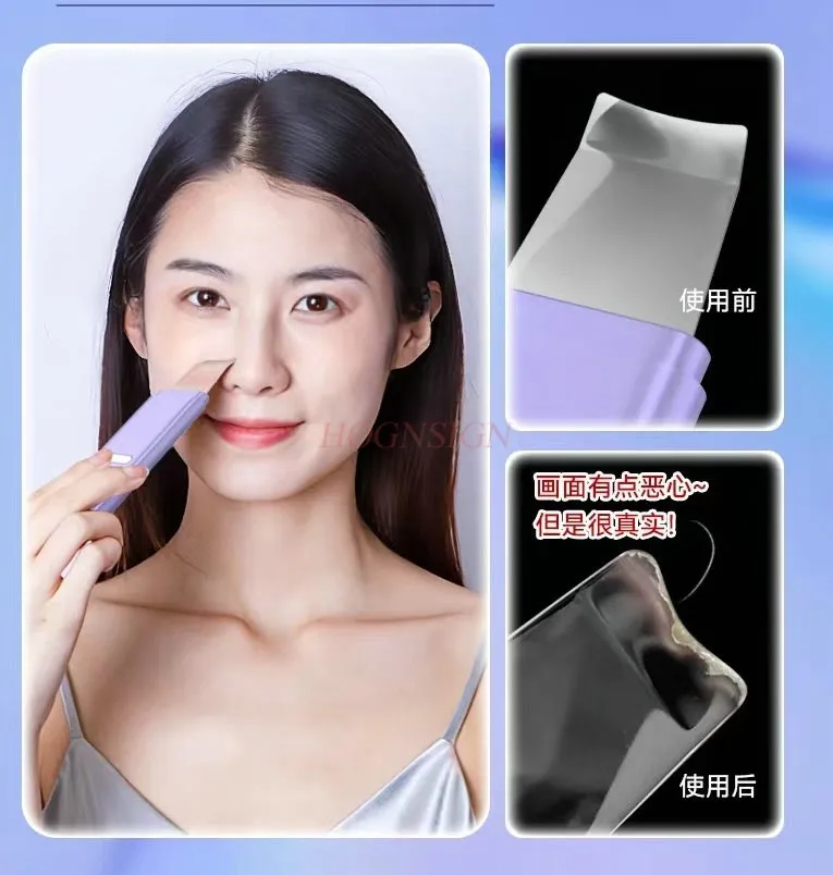 Blackhead removal instrument, ultrasonic peeling machine, beauty instrument, facial pore cleaning
