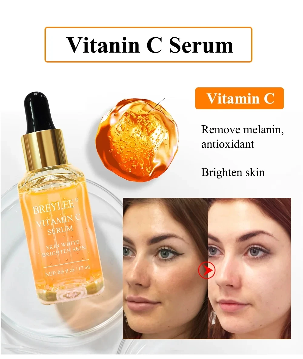 VC Whitening