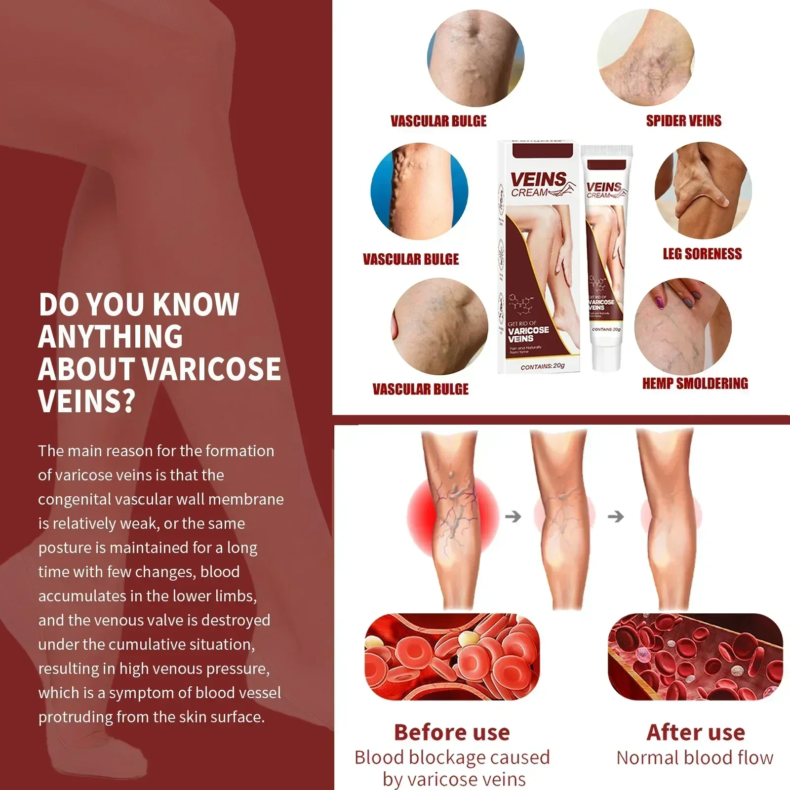 Safe and effective varicose vein removal Effective treatment of vasculitis Fast treatment of leg varicose vein removal Fast