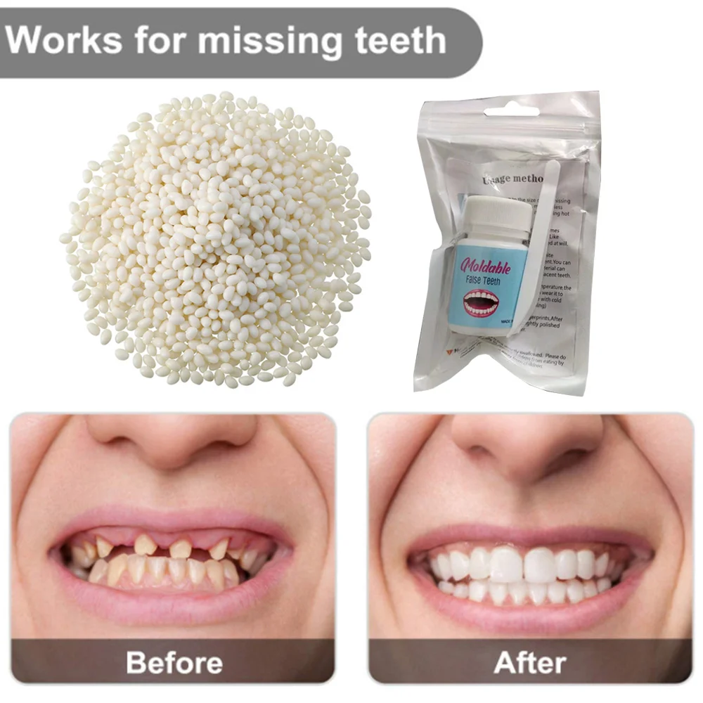 

Dental Resin Shapeable Teeth Glue Makeup Dentures Modification Temporary Filling Teeth Repair Broken Teeth Tooth Gaps Temporary