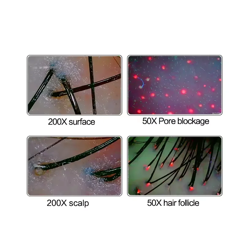 15 Inch HD Display 50/200X Professional Hair Follicle Detector Scalp Machine Oil Moisture Test Digital UV Skin Analysis Machine