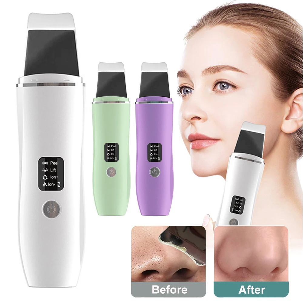 Facial Skin Scrubber Face Spatula, Ultrasonic Skin Spatula Scrubber  Blackhead Remover Gentle Peel Peeling Pore Cleanser Exfoliator Lifting Tool  Comedones Extractor USB Rechargeable