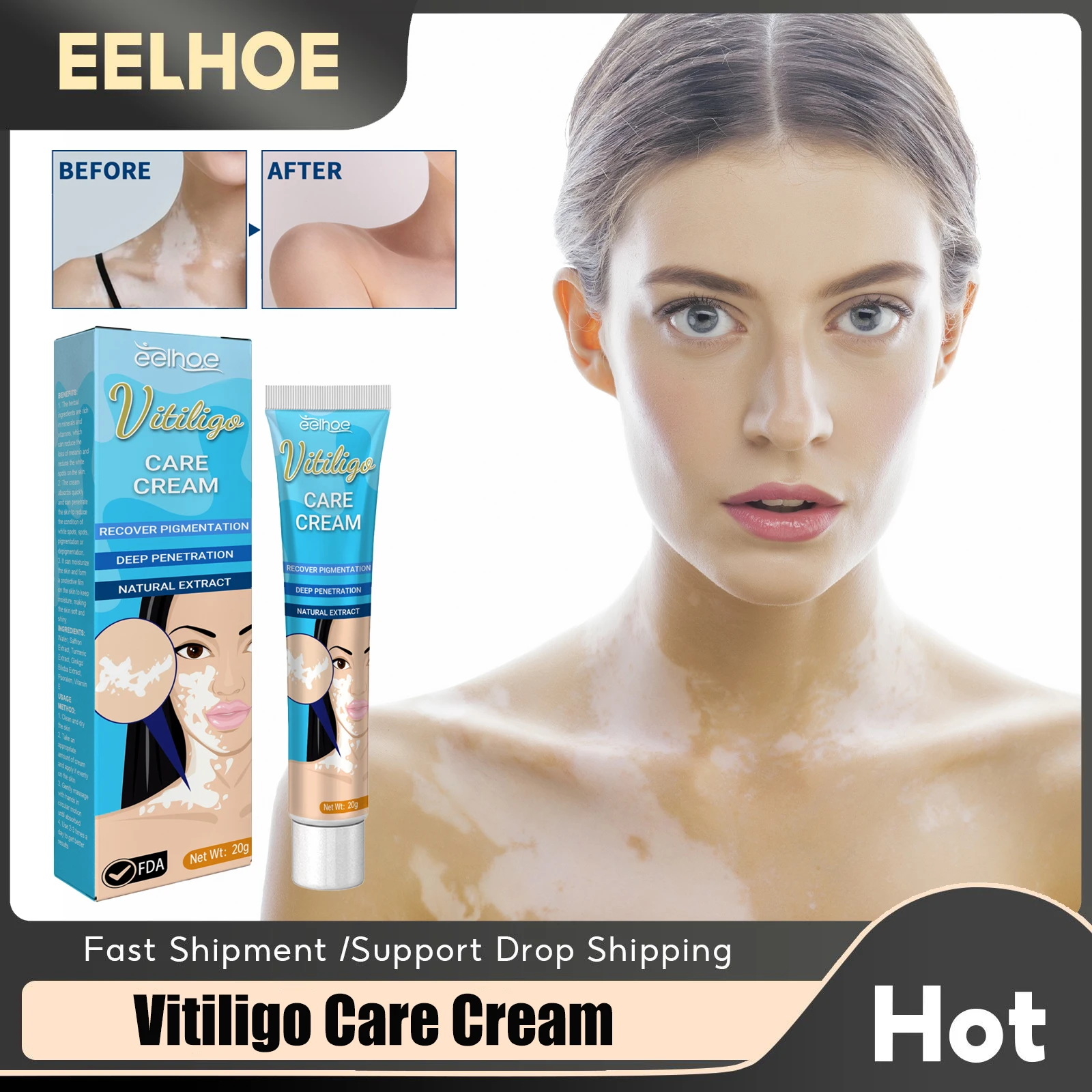 

Vitiligo Treatment Ointment White Spot Removal Fade Piebald Psoriasis Ringworm Disease Soothing Leukoplakia Herbal Repair Cream