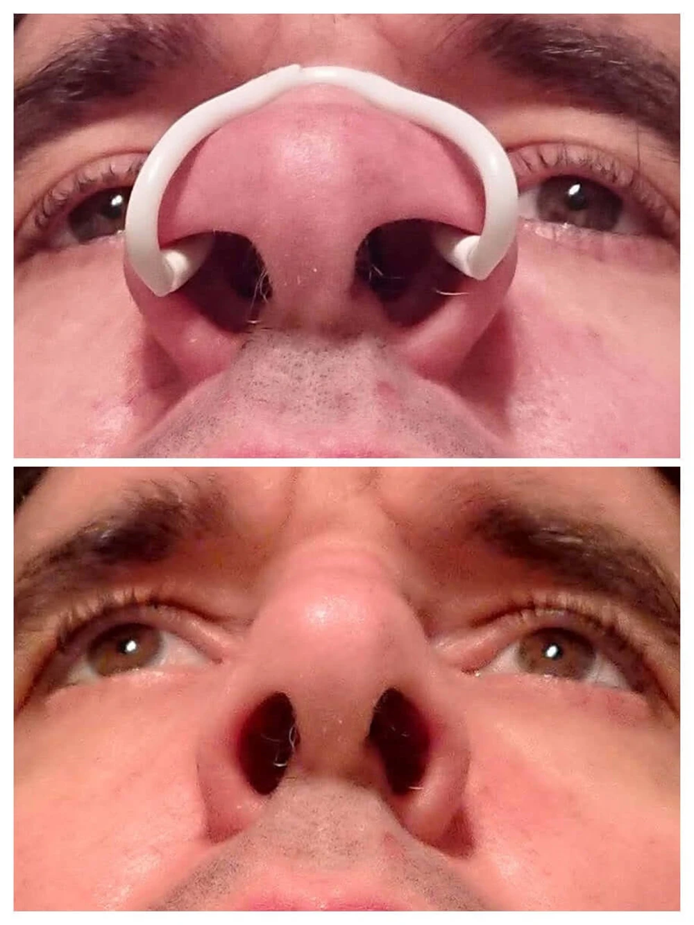 1/2/3/5/10 Pcs Anti Snoring Devices Nasal Dilator for Improve Nose Breathing Adjustable Breathable Nose Clip for All Nose Shapes 3