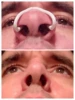 1/2/3/5/10 Pcs Anti Snoring Devices Nasal Dilator for Improve Nose Breathing Adjustable Breathable Nose Clip for All Nose Shapes 3