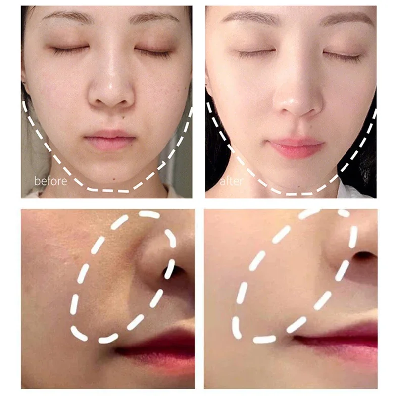 Electric Facial Beauty Devices Face Lifting Anti Wrinkle Facial Eye Massage Face Cream Introducer Skin Rejuvenation neck face massager face lifting roller electrotherapy skin care tool