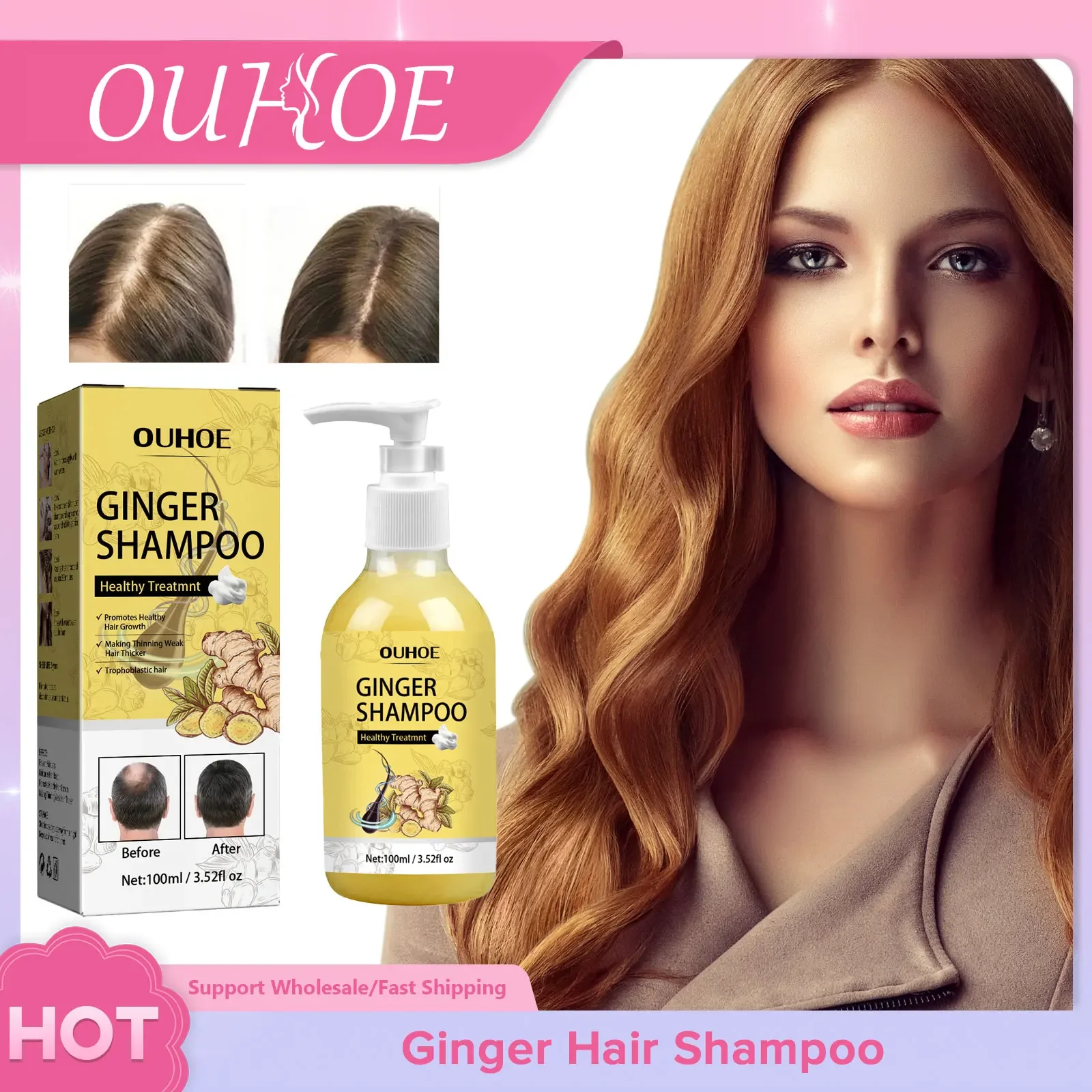 

Sdotter Hair Growth Shampoo Anti Itching Improve Split Ends Activate Follicles Effective Hydrating Scalp Environment Dense Hair