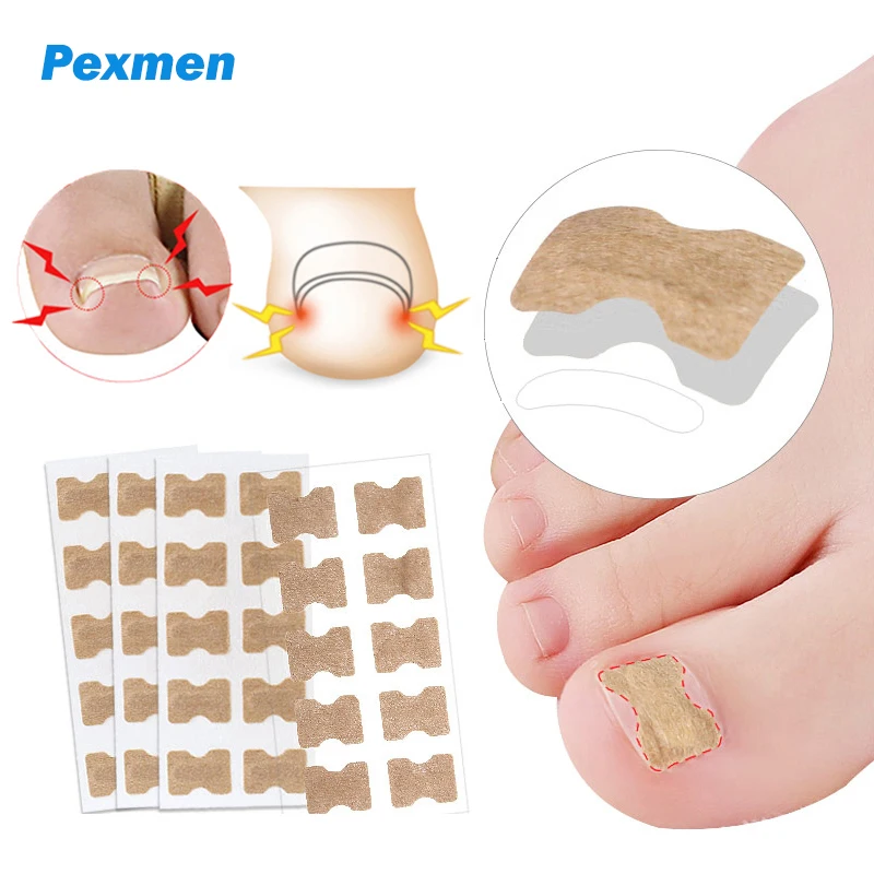 Pexmen 10/20/50/100Pcs Ingrown Toenail Correction Stickers Toenail Corrector Patch Big Toe Nail Corrector Patch for Women Men pexmen 10 20 50 100 200pcs ingrown toenail correction stickers toenail corrector patch big toe nail corrector patch