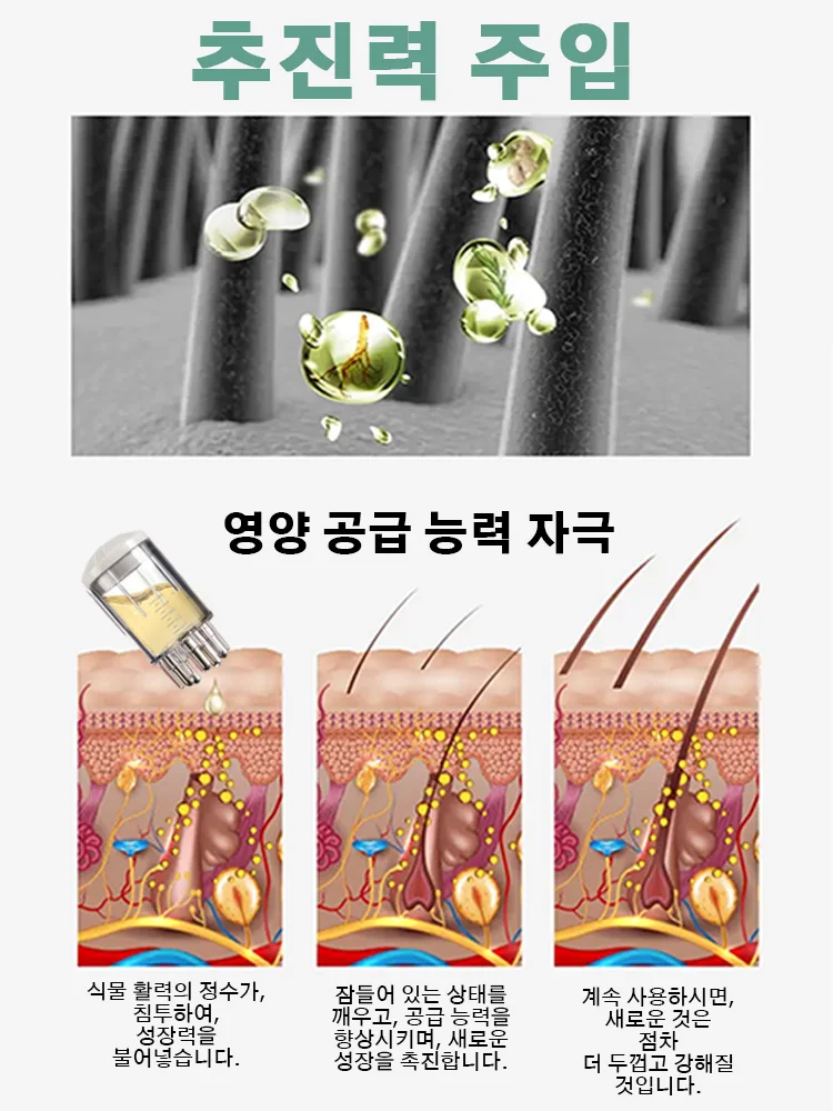 베스트셀러 5세대 스프레이 2026, 3초 흡수, 매일 모발 손상 감소