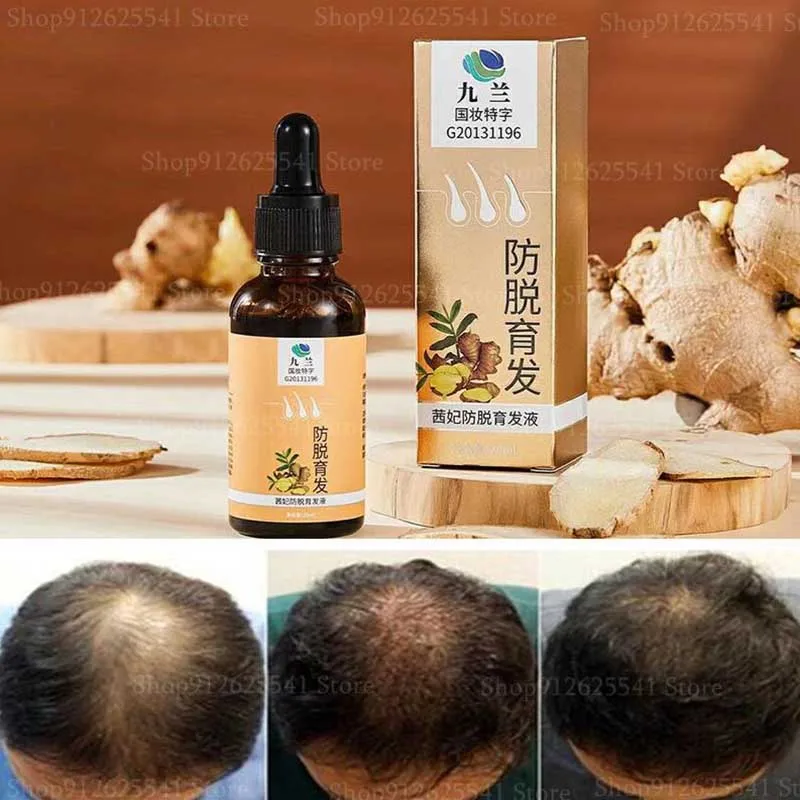 

30ml Polygonum Multiflorum Ginger Herbal Essence Hair Growth Anti-hair Loss Anti-itch Anti-Thinning Essence Hair Care Products