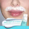 Lip Hair Removal Cream Hair Removal Cream For Face Fuzz Hair Remover Cream Upper Hair Removal Fuzz Remover For Facial 100g 4