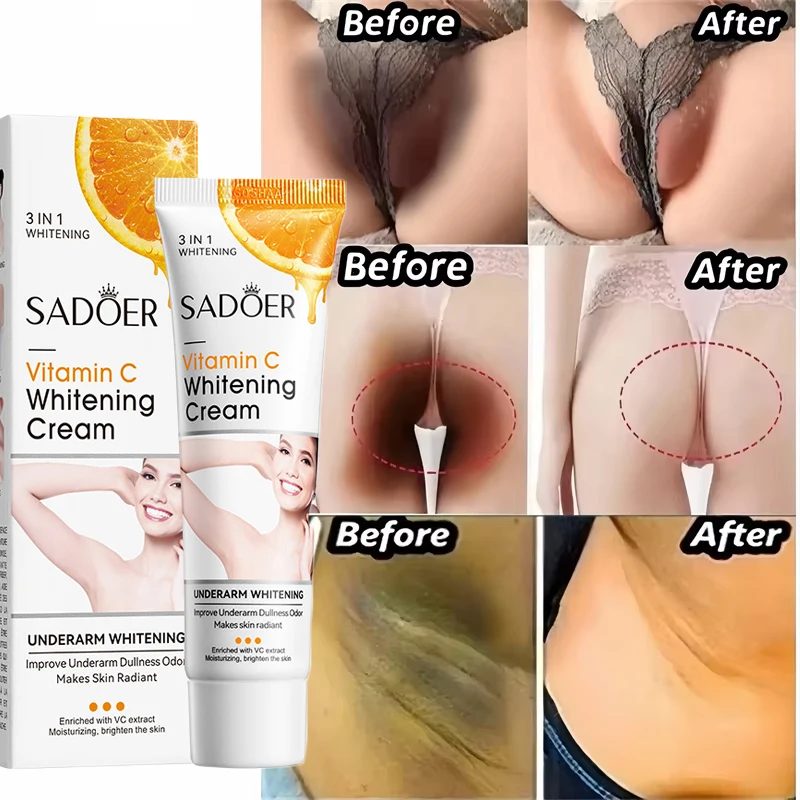 Body Whitening Cream Remove Thigh Inner Joint Dark Melanin Knee Bleach Private Part Whiten Lighten Moisturize Brighten Body Care 3