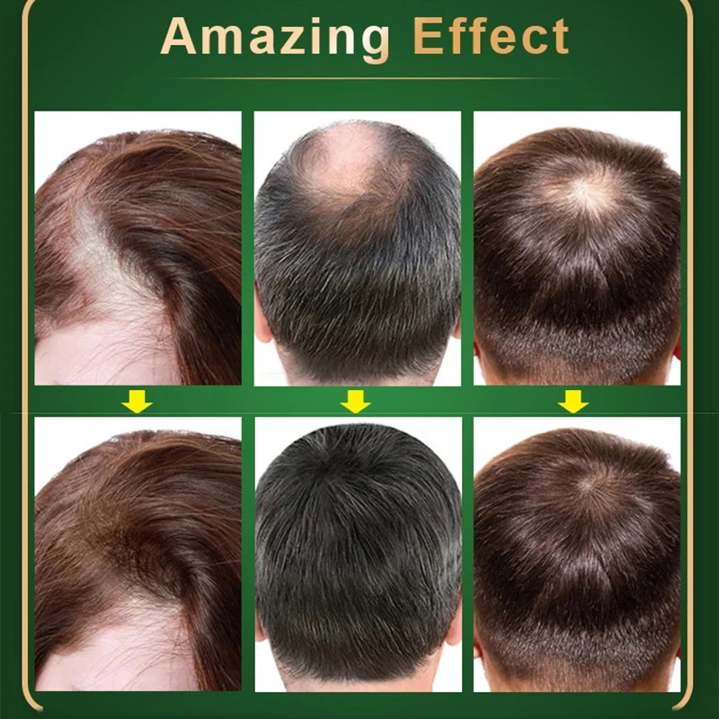 Original Thailand Neo Hair Lotion 120ml Hair Growth Oil Capillary Tonic For Growth Anti Loss Scalp Treatments Men hair growth serum,hair growth cream,hair growth spray,hair growth shampoo set,hair care oil