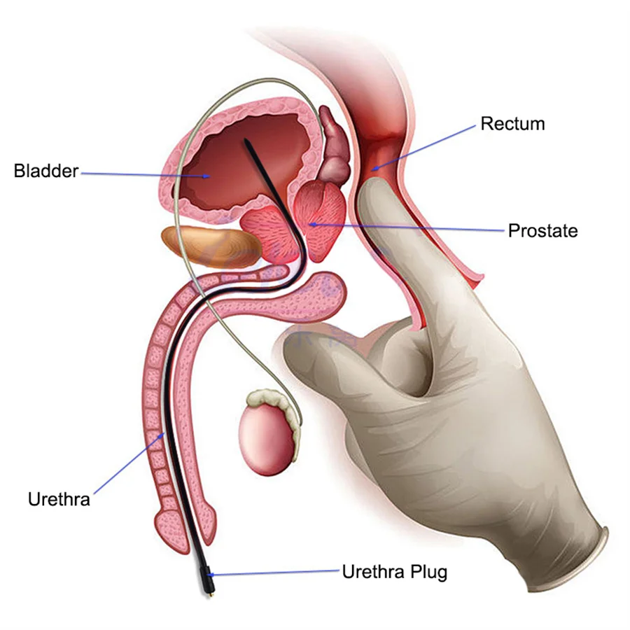 Penis Sex Toys Male Masturbator Electro Shock Horse Eye Stick Urethral Dilation