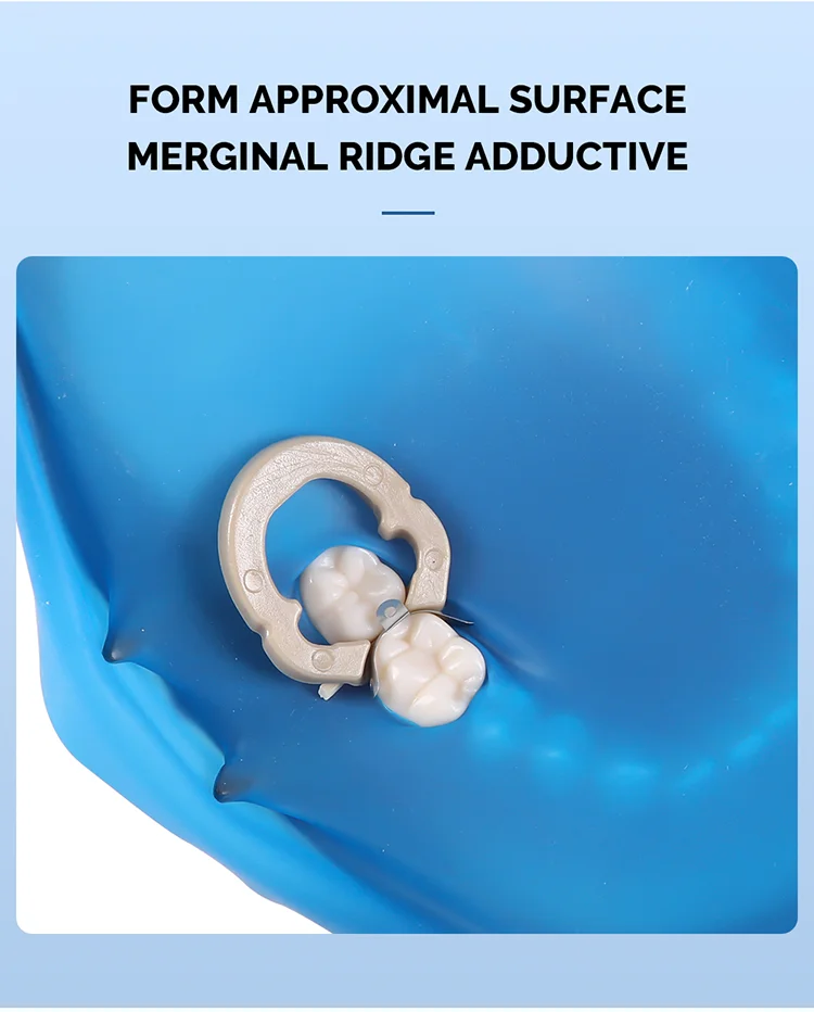 Dental Matrix Bands Schnittkonturierte Metall Matrizen Matrix Für Zähne Ersatz Zahnarzt Werkzeuge Zahnmedizin Material AZDENT – Detail 3