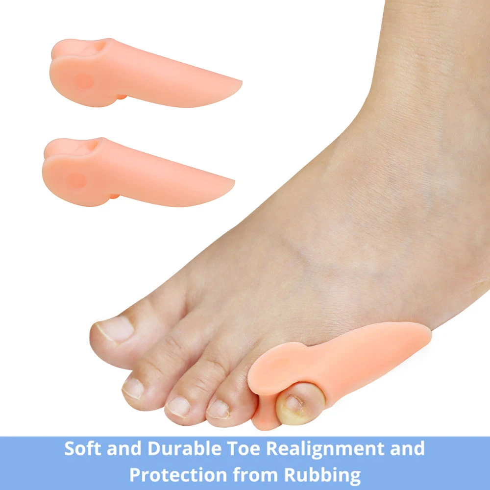 Pexmen 2Pcs Gel Pinky Toe Separator Tailor's Bunion Corrector