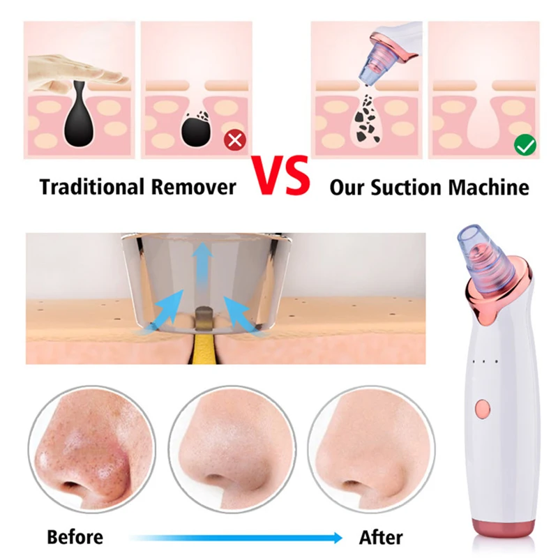 Electric Facial Blackhead Remover Vacuum Pore Cleaner Acne Cleanser Black Spots Removal Face Nose Deep Cleaning Tools view 6