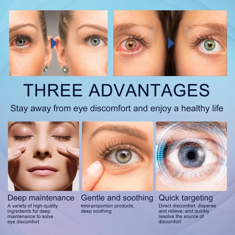 Eye Care Drops Eye Care Drops Treatment redness Blurred Vision Improve Enhance Eyesight Relief Eye Fatigue Dry itch Sooth Eyesight
