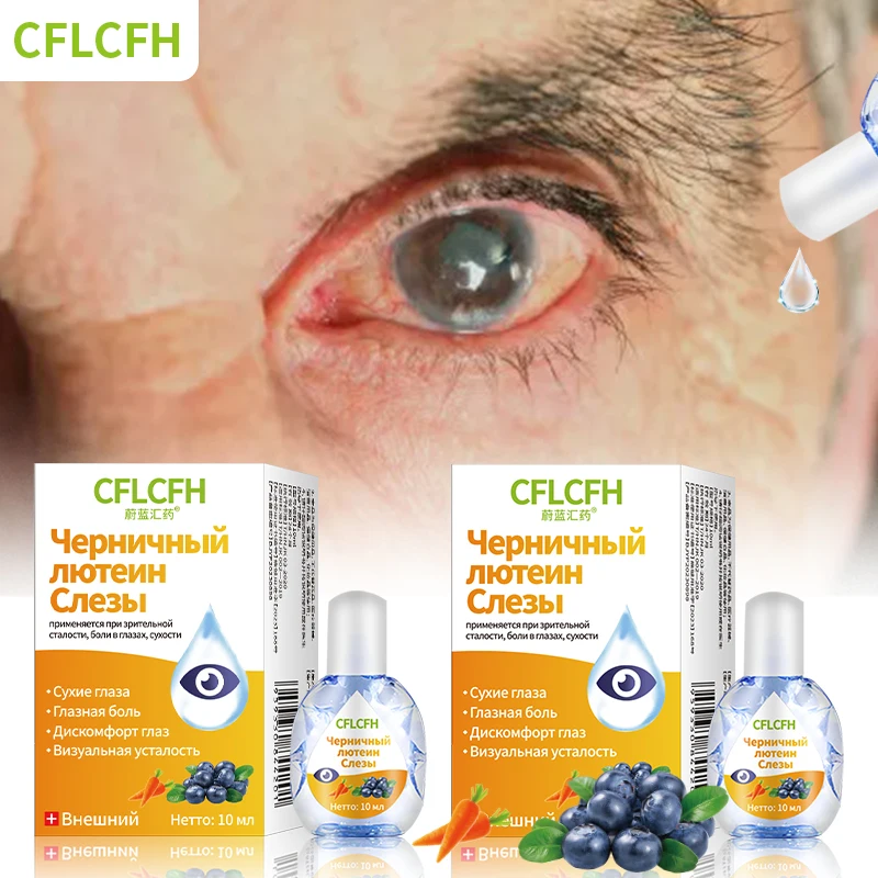 

Cataract Removal Care Myopia Eyes Pain Dry Itchy Visual Fatigue Protect Vision Blueberry Lutein Eye Drops Russian Language