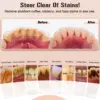 Ultrasonic Dental Scaler For Teeth Tartar Stain Tooth Calculus Remover Electric Sonic Teeth Plaque Cleaner Dental Stone Removal 5