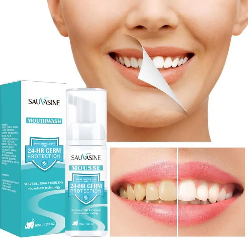 

Teeth Whitening Mousse Yellow Stains Cleansing Toothpaste Removal Foam Germ Protection Mouthwash Oral Hygiene Freshens Breathe