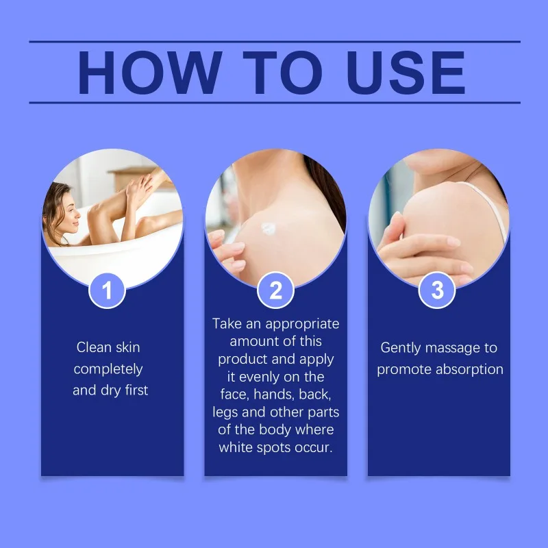 Vitiligo Treatment Cream Melanin Growth Cream Remove White Spot Eliminate Vitiligo Antibacterial Body Skin Care vitiligo ointment