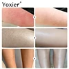 Keratosis Pilaris Repair Cream Vitamin E Skin Care Moisturizing Remove Hard Lumps Dry Rough Adjust Skin Tone Tighten Skin 50g 3