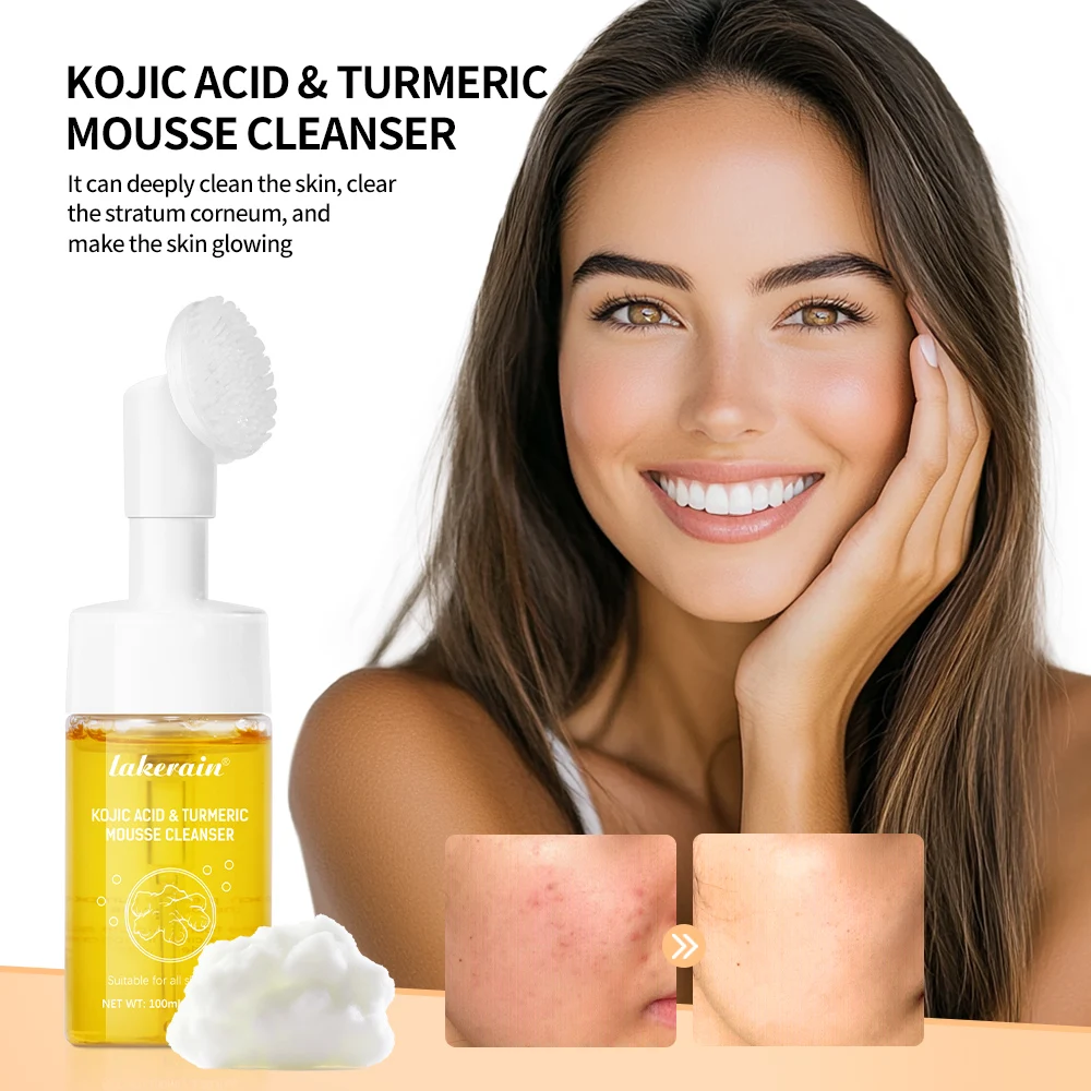 Kojic Acid Turmeric Mousse Cleanser Deep Cleans Pores Reduce Acne Hydrating and Moisturizing Reduce Clogging Doesn't Tighten 2
