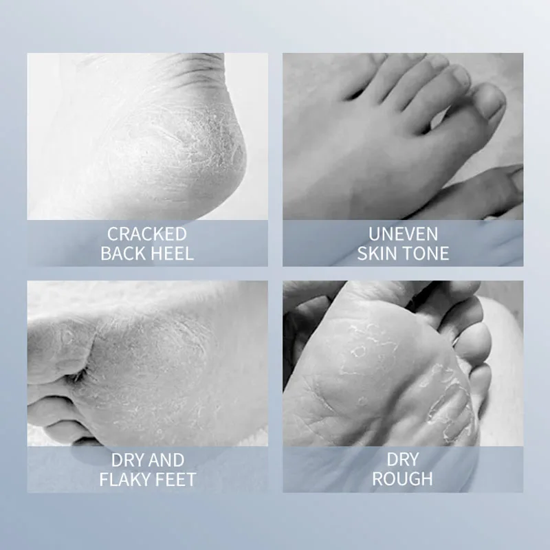 SADOER Goat Milk Foot Mask Moisturizing Foot Peeling Mask Anti-aging Exfoliating Feet Pedicure Exfoliant Feet Skin Care