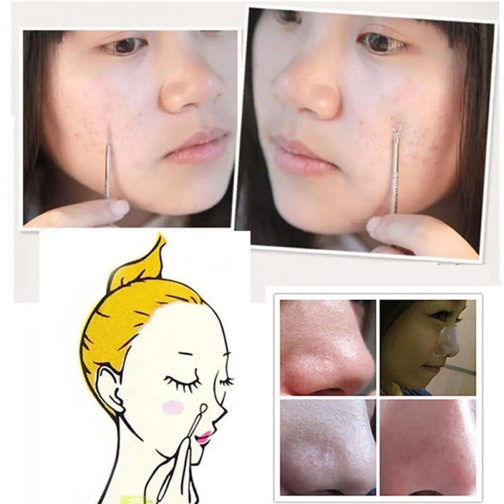 Comedone Acne Extractor Stainless Steel Needles Pimple Blackhead Remover Tool