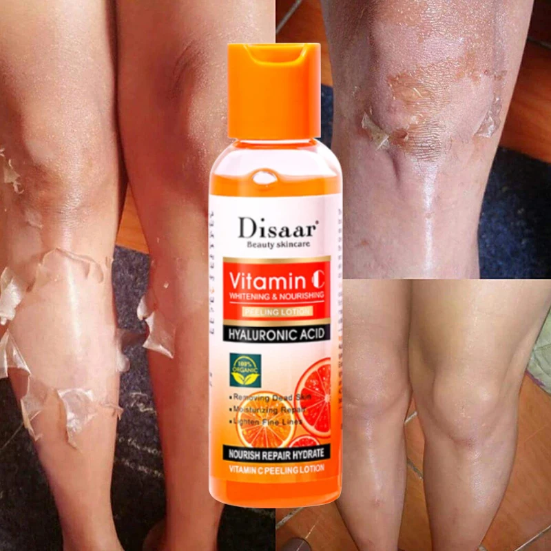 

Peeling Lotion For Dark Skin Whitening Lightening Melanin Knuckles Knees Elbows Brighten Moisturizing Body Skin Care 100g