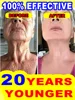 wrinkles disappear，20 years younger 2