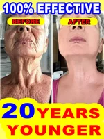 wrinkles disappear，20 years younger 2