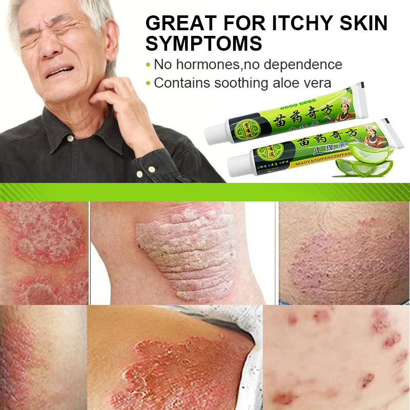 2pcs Psoriasis Mint Anit-itch Cream Jock Itch Beriberi Fungal Infection Treatment Ointment Medical Herbal Psoriasis Cream A1442
