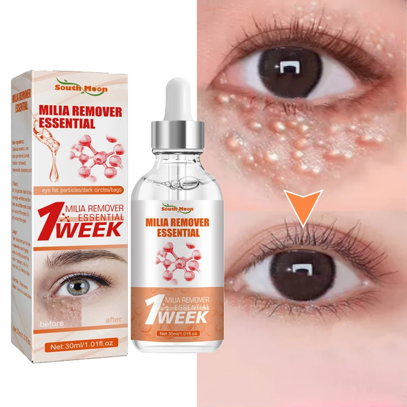 Fat Granules Removal Eye Serum Eye Milia Repair Treatment Products Wrinkle Lifting Moisturizing Anti-Puffiness Korean Skin Care facial serum facial essence retinol face serum salicylic acid facial serum