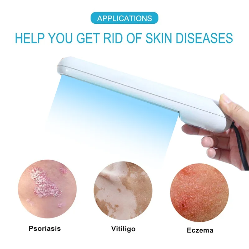 311nm Uvb Vitiligo Large Area Household White Spot Psoriasis uvb Narrow Spectrum Ultraviolet Therapeutic Apparatus