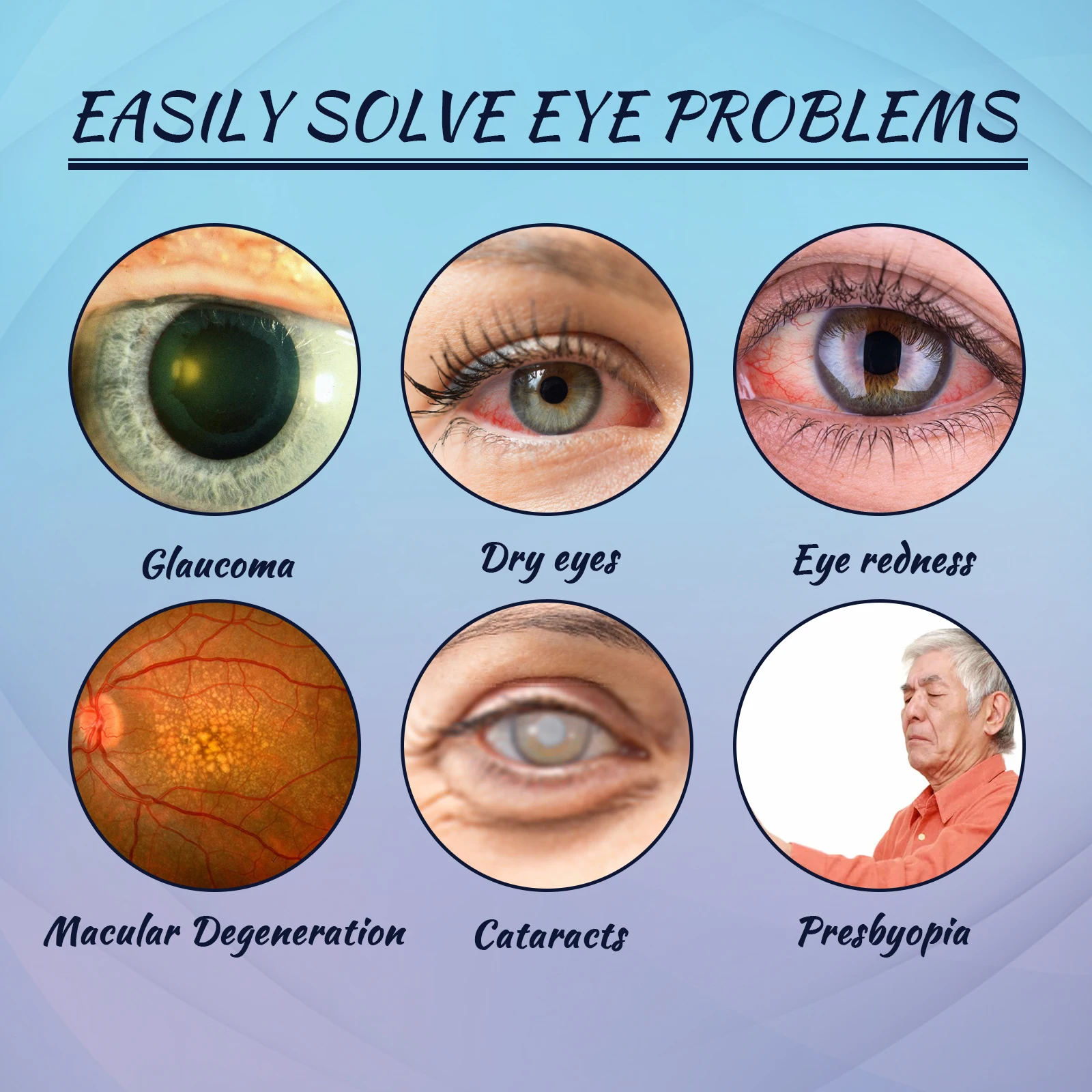 Eye Drops: Eye Care Solution for Relieving Redness, Dizziness, Eye Fatigue, Dryness, Blurred Vision, and Moisturizing Eyes - 2