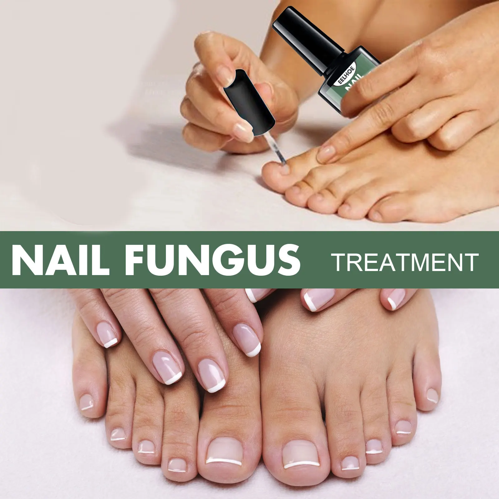 Nail Fungal Treatment Essence Oil Foot Toe Nail Fungus Removal Serum  Repair Onychomycosi Anti Infection Gel Care Products