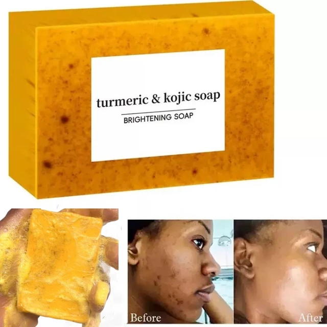 Lemon Turmeric Kojic Acid Soap Brightening for Dark Skin Glowing Even Skin Tone Smooth Deep Cleansing Oil Control Face Skin Care