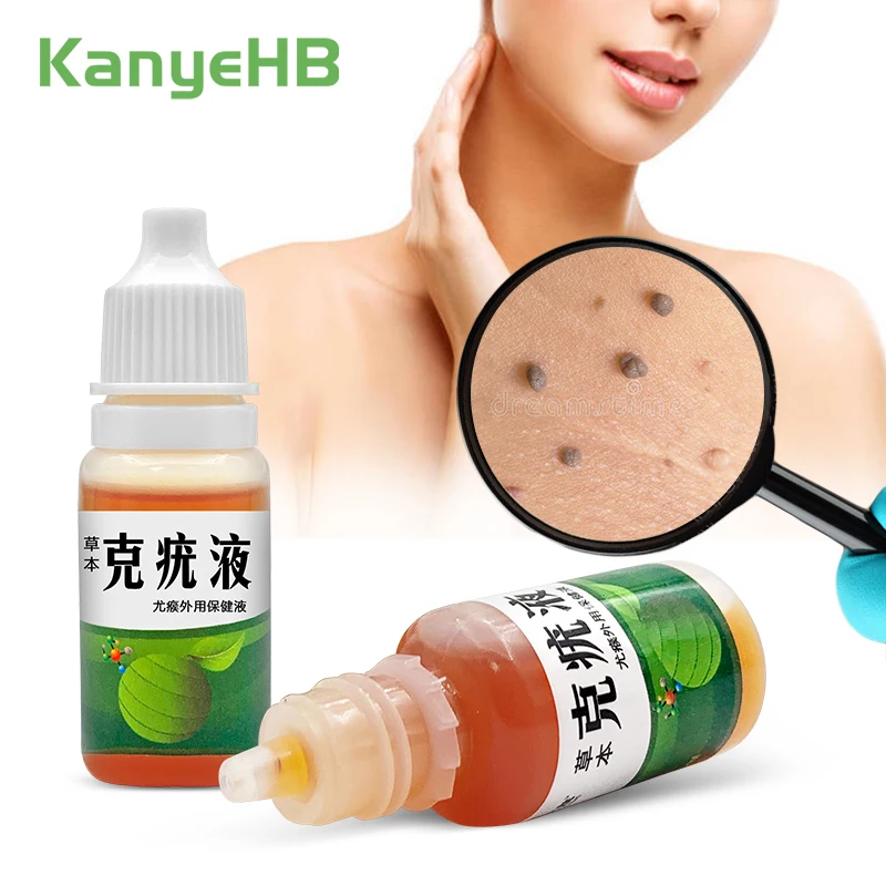 

2pcs Wart Removal Liquid Wart Treatment Liquid Genital Wart Neck Mole Face Tags Remove Warts Fluid Painless Wart Removal A1392