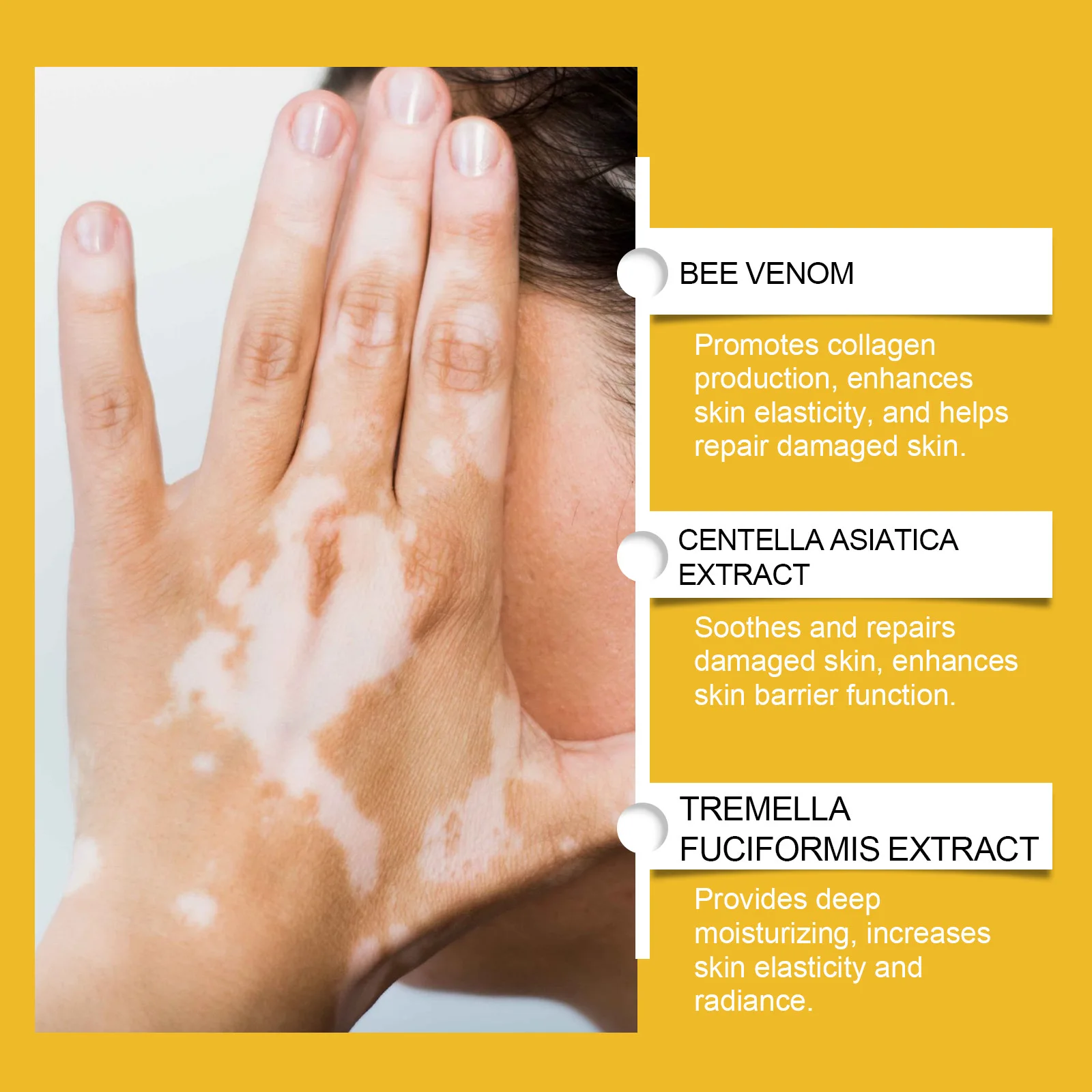 Bee Venom Vitiligo Soothing Cream Reament Repair Leukoplakia Reduce Pigment Melanin Antibacterial Moisturing Skin Care Cream