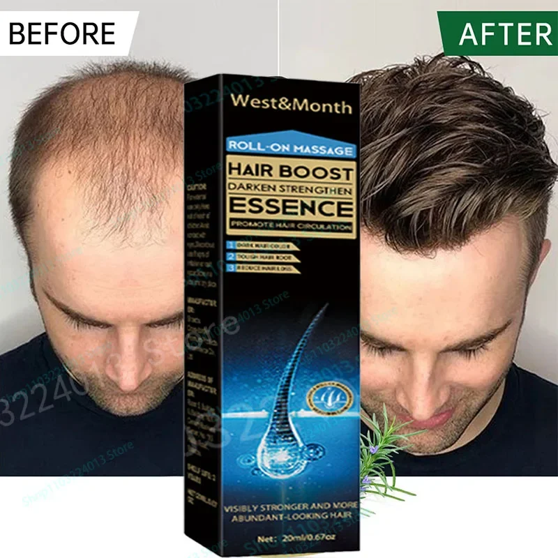 

Эфирное масло для ухода за волосами 7 дней улучшает состояние кожи головы лечение выпадения волос уход за волосами эфирное масло