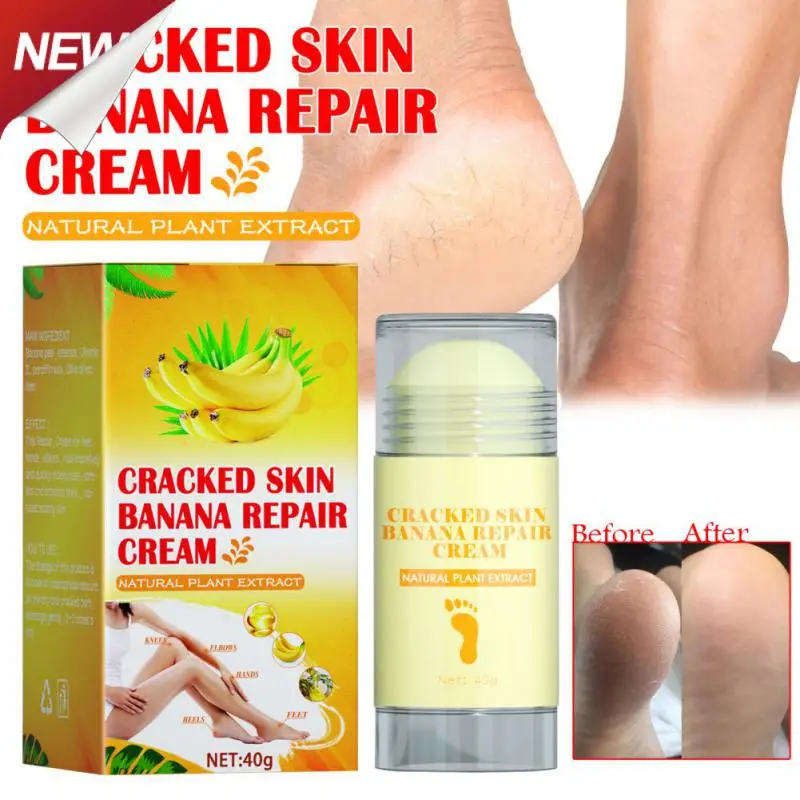 

Itch Relief Moisturizing Soothes Itchy Feet Hydration Repair Nourishing Foot Cream For Itchy Feet Foot Care Highly Effective