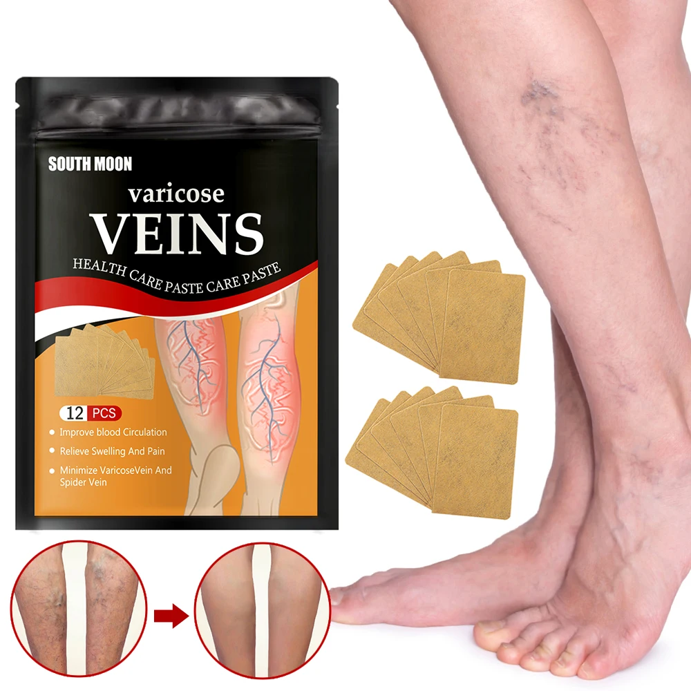 Varicose Veins Patch 12/24PCSBag Varicose Veins Treatment Patch Legs Sore Swelling Plaster Promote Metabolism Promote Smooth Blood Circulation Unisex