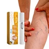 Lampshade Therapy Leg Repair Pen  Improving Blood Circulation Varicose Veins Relieves Leg Bulge Discomfort Pen Skin Care Product 1