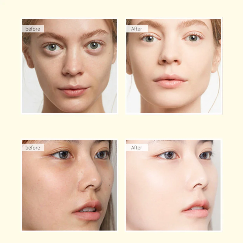 Glutathione Serum Whitening Ampoule Fade Dark Spot Improve Skin Elasticity Even Skin Tone Brightening