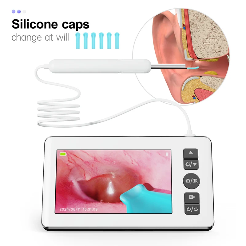 Digital Otoscope with 4.3 inch Screen 1080p HD Smart Visual Ear Camera Ear Wax Removal Tool Support Photo Video Recording