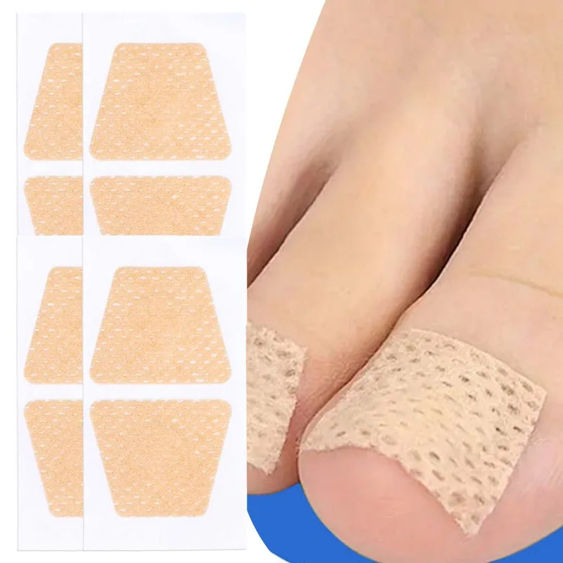 Fabric Ingrown Toenail Correction Stickers for Foot Health Care