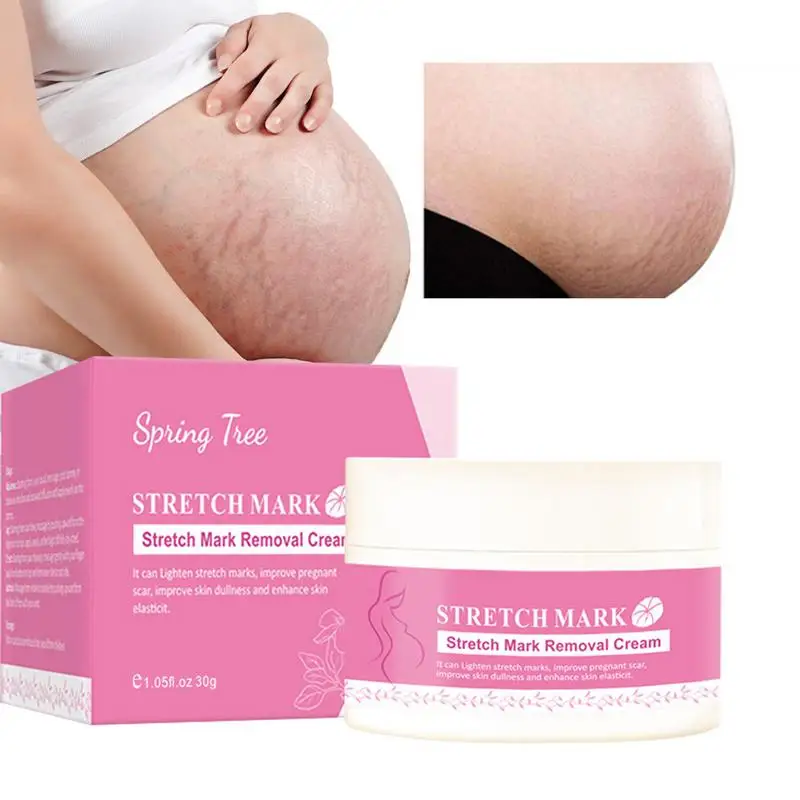 

Pregnancy Stretch Mark Cream Pregnancy Cream Nourishing Body Cream Moisturize And Encourage Skin's Natural Elasticity During